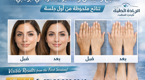 تفتيح وتبييض وتقشير البشرة في أبوظبي | بشرة صافية تبدأ من أول جلسة